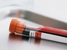 Дієта, продукти та народні засоби, що знижують цукор засоби