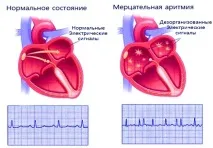 избегнем