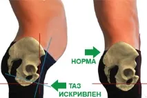 Як прибрати живіт, Медичний центр центр