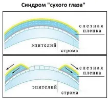 очей