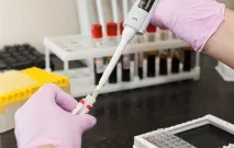 Норма прогестерону при вагітностінебезпеки та фактори відхилень відхилень
