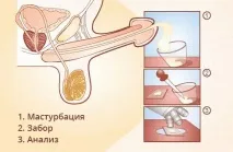 Норми для спермограми показники, розшифровка аналізу спермограми