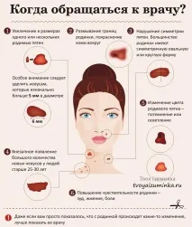 Чи небезпечні родимки небезпечні