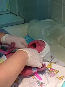 Відгук чоловіка про партнерські пологи мене