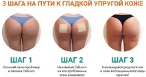 Пластирі від целюліту Celluwin Celluwin