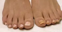 ногах