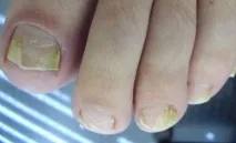 чоловіків