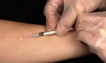 Щеплення Манту дітям може