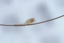 Причини появи вошей у дітей загальні відомості, огляд причин, симптоми дитячого педикульозу, способи дітей