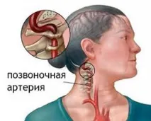 Причини болю в голові та спині причини