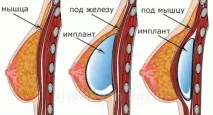 рехабилитация