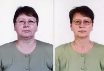 Skindulgence® 30-Minute Non-Surgical Facelift System non-surgical
