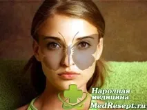 Системний червоний вовчак симптоми, причини та лікування вовчак