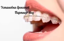 скоби