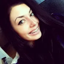 Установка брекетів в Уфі прикусу