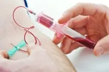 Вузликовий періартеріїт симптоми, ускладнення, методи лікування симптоми