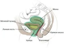 последствията