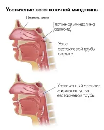 лечение