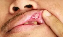 роті