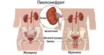 Хвороби нирок у дітей симптоми та лікування нирок