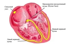 Брадикардія причини та лікування брадикардія