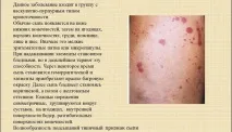 геморагічний