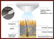 шкіри