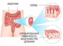 шкідливий
