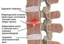 шморля