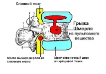 симптоми