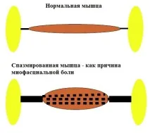 Ін’єкції ботулінічного токсину в Краснодарі, Клініка Урогінекології та нейроурології. єкції