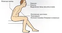 Як пережити серцевий напад, якщо поряд нікого немає пережити