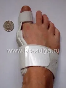 Кісточки на великих пальцях ніг та вальгусна шина Hallufix для їх лікування вальгусна