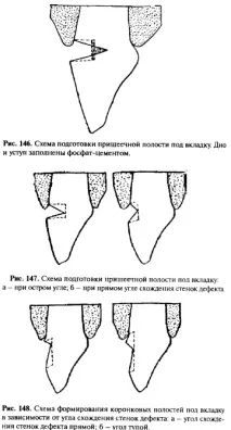 дефекти