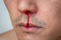причини