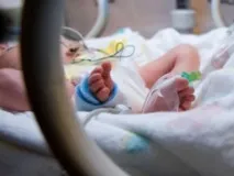 Охолодження немовлят, що задихнулися під час пологів, подвоює їх шанси на життя - МедНовости подвоює