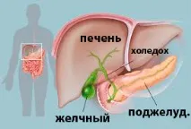 Перегин жовчного міхура міхура