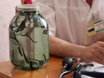 П’явки при простатиті або гірудотерапія – простий засіб у лікуванні захворювання простатиті