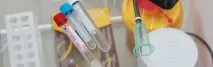Наслідки підвищення антитіл до ТПО наслідки