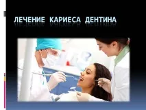 Презентація на тему - Лікування карієсу дентину - з медицини лікування