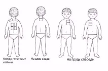 Прогрівання при кашлі як не нашкодити своїй дитині нашкодити