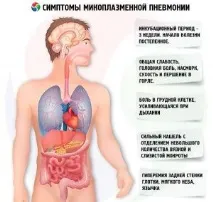 Симптоми, діагностика та лікування мікоплазмової пневмонії лікування