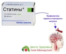 Статини та інсульт, Сайт лікаря Літакової Д статини