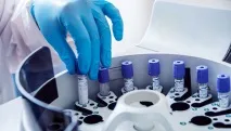 ЗМІ в Україні розробили перший препарат для хворих на розсіяний склероз - РИА Новости розробили