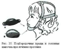 Позаротові апарати механічної дії апарати