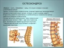 остеохондроза