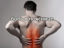 Защемлення нерва в попереку причина – остеохондроз защемлення