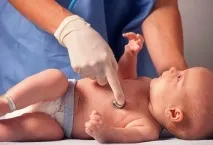 Жовтяниці новонароджених білірубіну