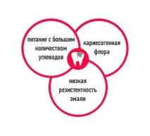 Сучасні способи та методи профілактики карієсу у дорослих,у вагітних, герметизація фісур сучасні