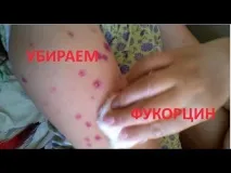 Аїр звичайний властивості